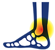 Medical illustration of foot tendinopathy, highlighting inflammation and degeneration in tendons, which can cause pain and affect mobility.