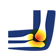 A medical illustration of Shoulder and Arm tendinopathy, highlighting inflammation and degeneration in the tendons, which can cause pain and affect mobility.